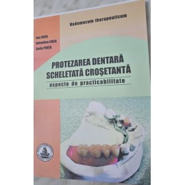 CONCEPEREA PROTEZELOR SCHELETATE CROSETANTE (aspecte practice)