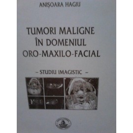 TUMORI MALIGNE IN DOMENIUL ORO-MAXILOFACIAL