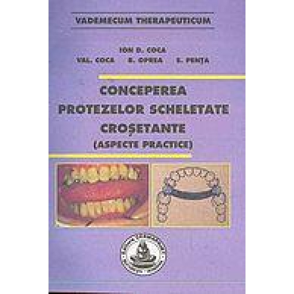 CONCEPEREA PROTEZELOR SCHELETATE CROSETANTE (aspecte practice)