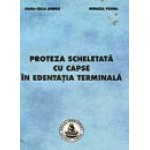 PROTEZA SCHELETATA CU CAPSE IN EDENTATIA TERMINALA