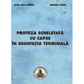 PROTEZA SCHELETATA CU CAPSE IN EDENTATIA TERMINALA