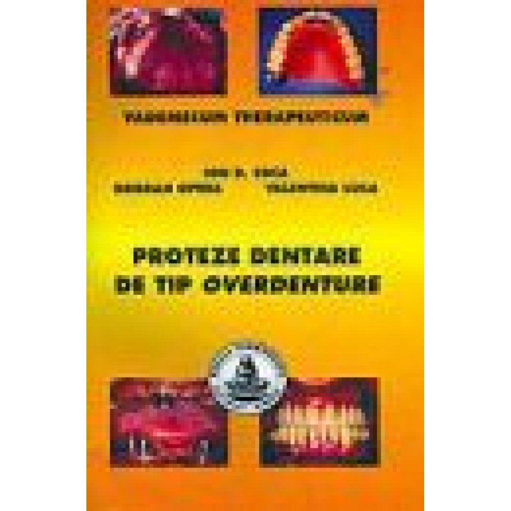 PROTEZE DENTARE DE TIP OVERDENTURE