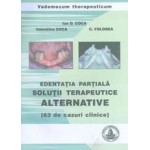 EDENTATIA PARTIALA – SOLUTII TERAPEUTICE ALTERNATIVE - 63 de cazuri clinice) – I. COCA, V. COCA