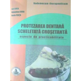 PROTEZAREA DENTARA SCHELETATA CROSETANTA - aspecte..