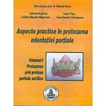 ASPECTE PRACTICE IN PROTEZAREA EDENTATIEI PARTIALE